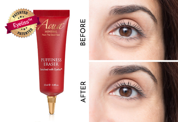 Say Goodbye To Puffy Eyes